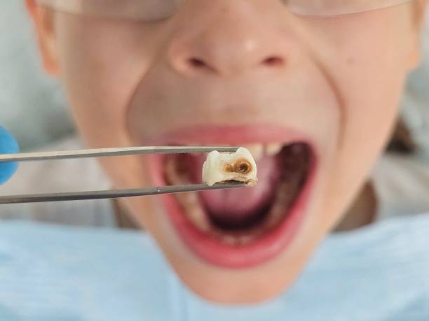 Best Cosmetic Emergency Dentistry in Chowchilla, CA